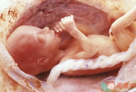 怀孕33周胎儿绕颈两周怎么纠正,33周脐带绕颈2圈羊水少能不能跳