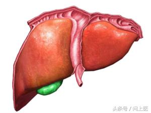 胆囊息肉手术是切除息肉还是胆囊,长胆囊息肉会出现哪些症状