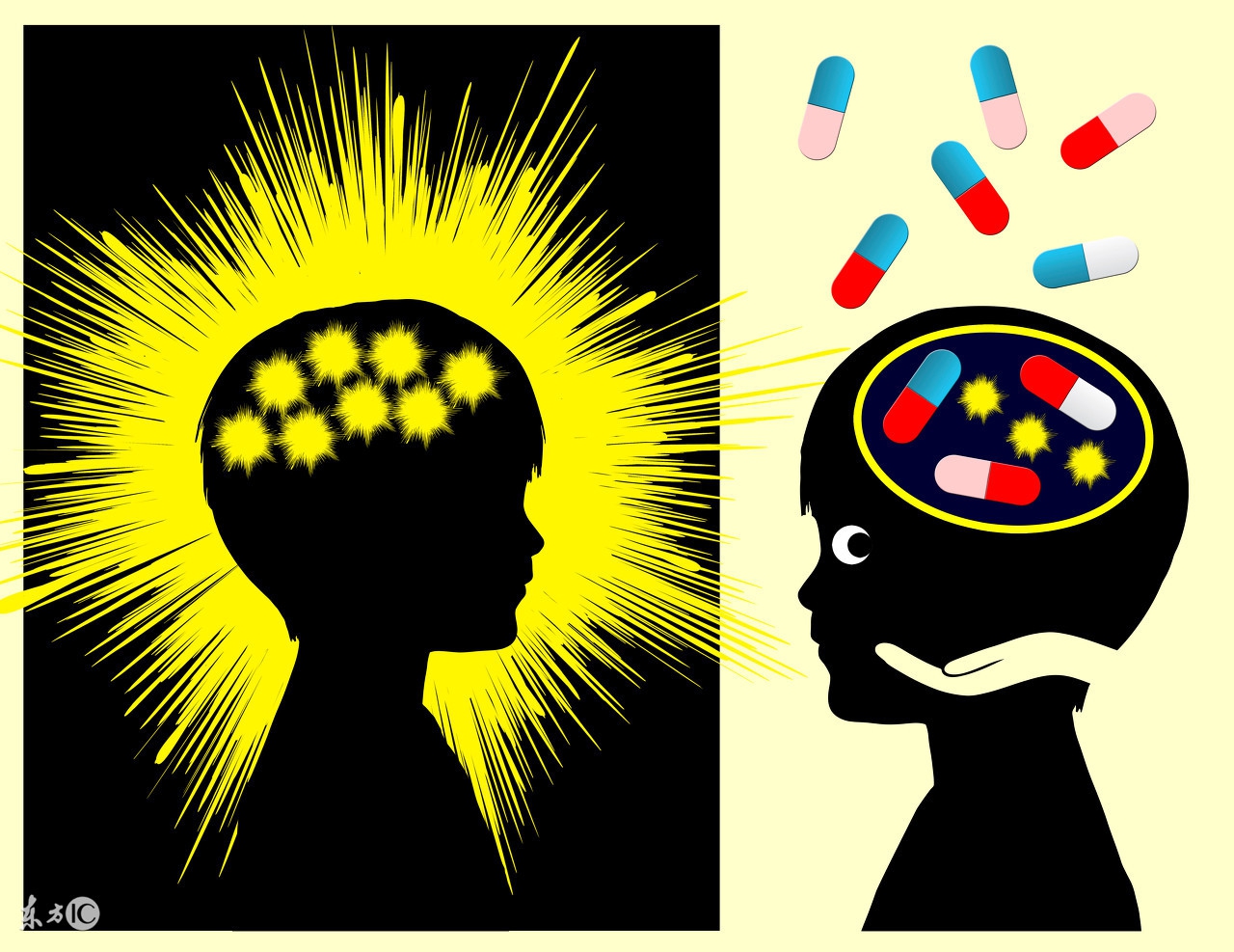 引起儿童良性癫痫的原因是什么,儿童脑病引发的癫痫能根治吗