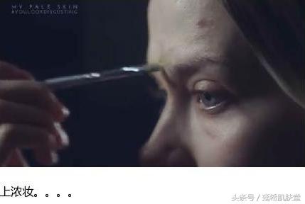 “你如果不长痘一定很好看”——长痘患者的自述