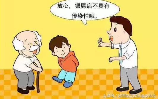 银屑病皮肤病患者,皮肤病银屑病患者