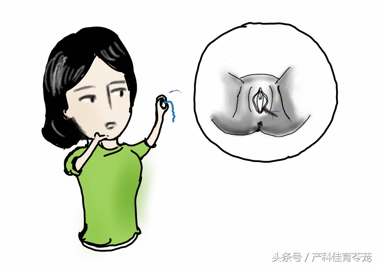 给您支几招，避免不必要的会阴侧切