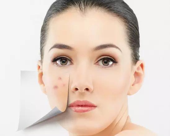 错误的护肤方法可能会毁掉皮肤,你的护肤常识正在伤害你的皮肤