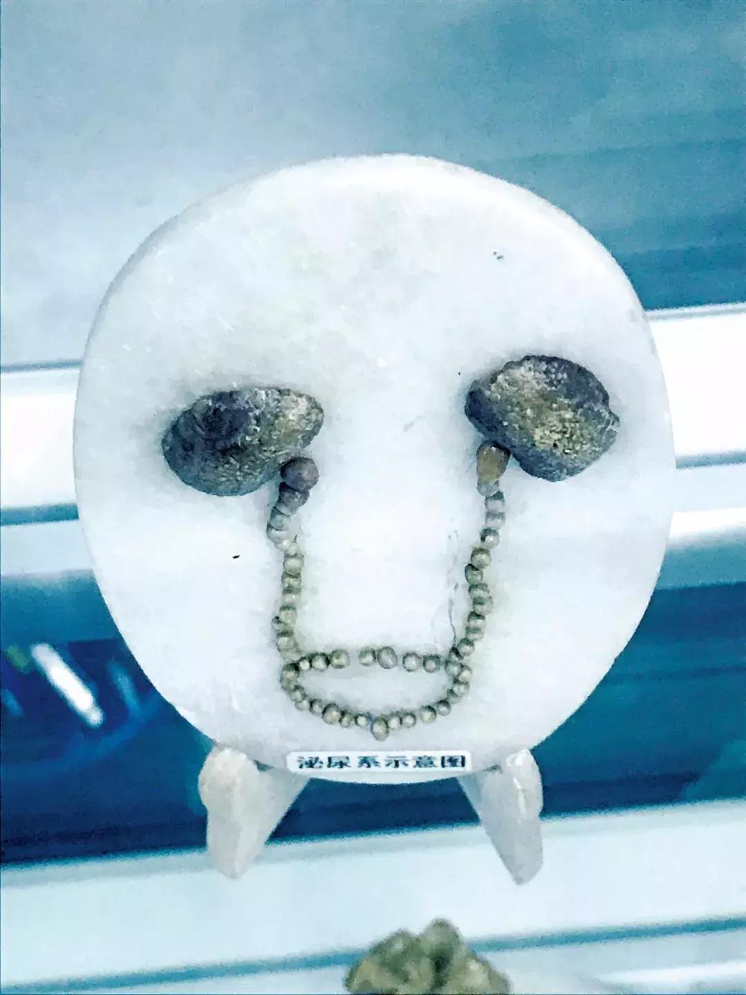 他把人体的“下水道工程”做到极致患者称他是泌尿结石终结者