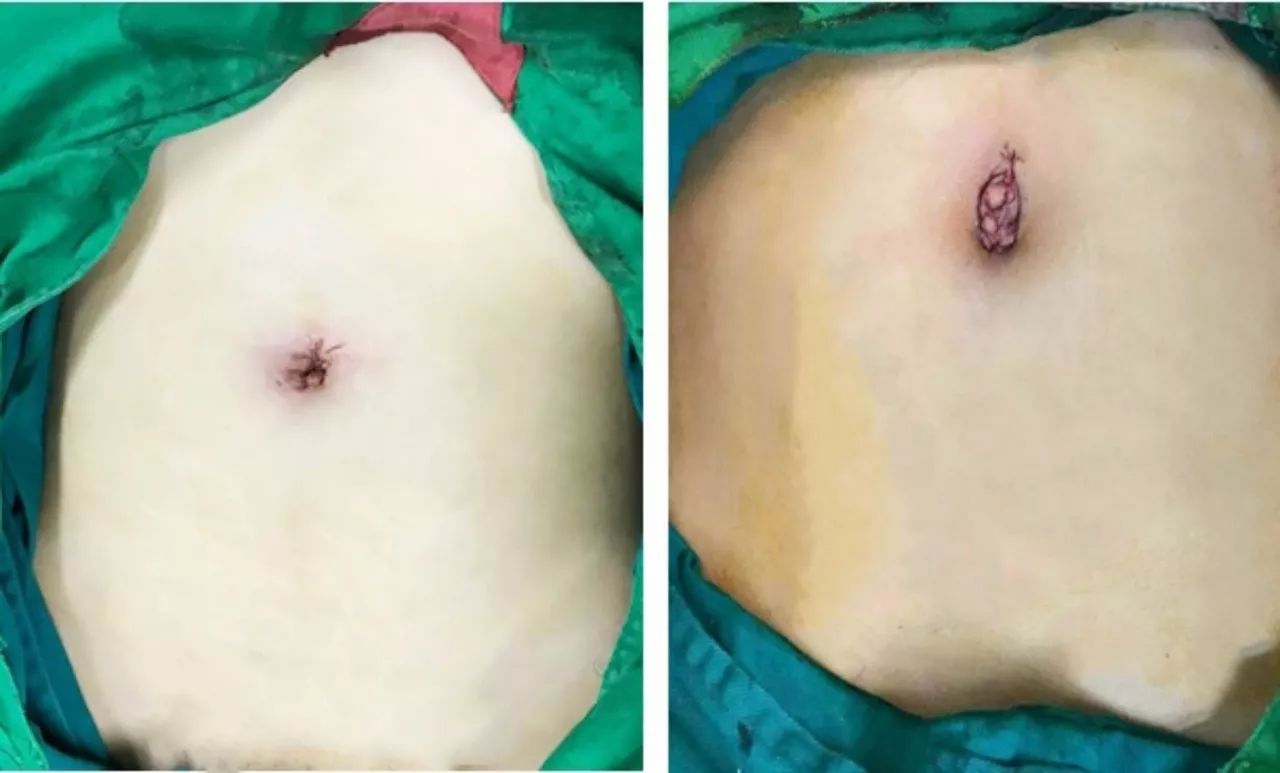 女*福性**利︱深圳市中医院妇科专家再添佳音