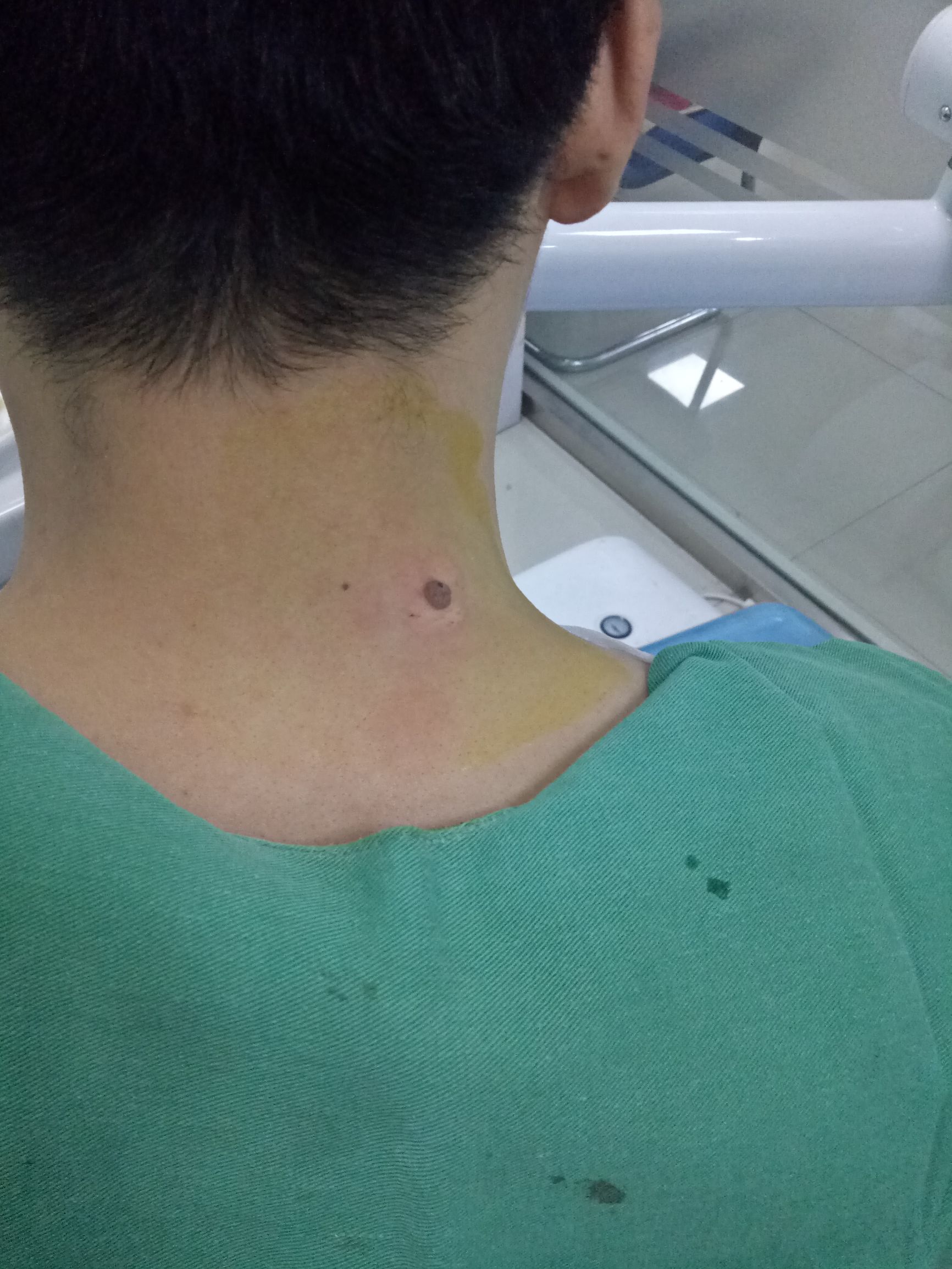 男人肩上扛着痣好吗,肩上扛痣的人是不是很苦