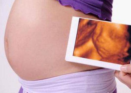 四维彩超预测宝宝长相项目,四维彩超可以看到小孩样子吗