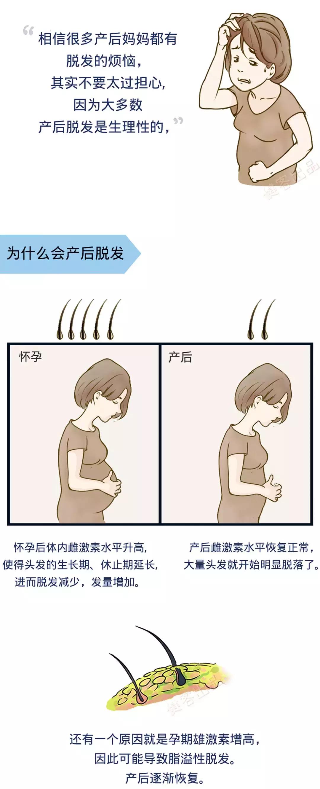 产后脱发属于休止期脱发吗,产后妈妈脱发