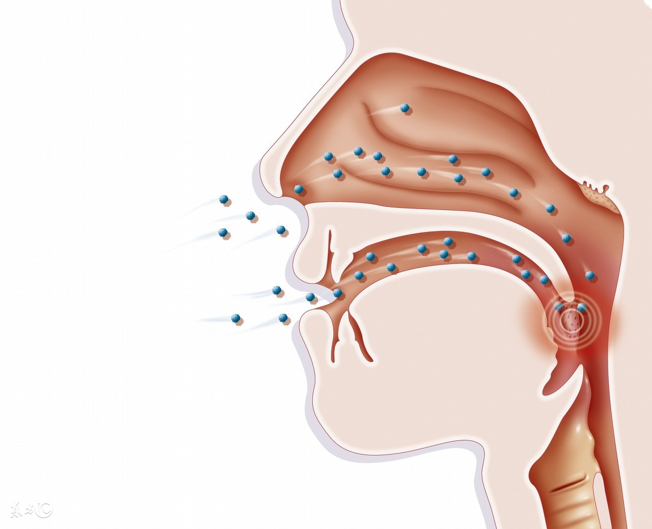 扁桃体发炎怎么越吃药越严重,扁桃体发炎药物治疗