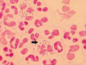 绿脓杆菌致儿童死亡率极高，但做爸妈的更要注意这两种病菌！