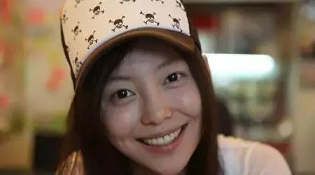 医美一键美颜的项目,比光子嫩肤更好的医美是什么