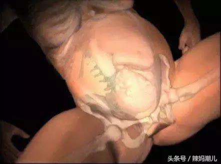 顺产是撕心裂肺的疼？高清图揭示分娩的真相！