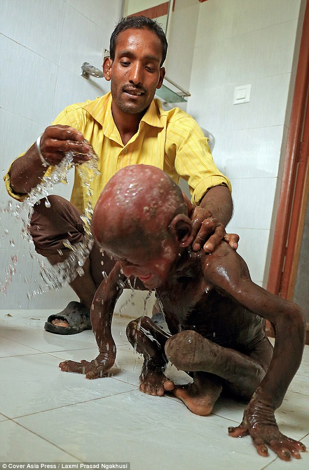 小男孩一出生无鼻无耳无眼,小男孩一出生奇丑无比