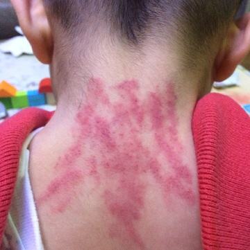 宝宝一直故意咳嗽,宝宝一直咳嗽是怎么回事