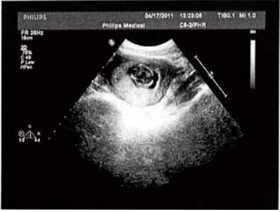 b超能看到宝宝形状吗,如何看b超单辨别婴儿长相