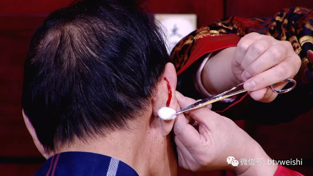 贺氏针灸养生堂视频全集,贺氏针灸养生堂