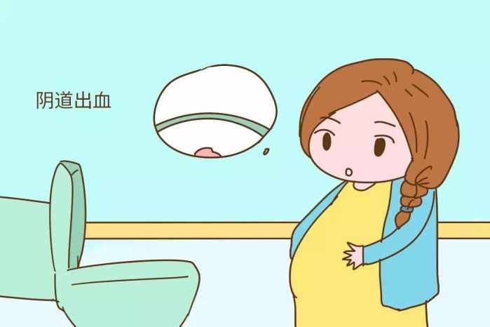 孕期一定要注意这些早产征兆，预防更重要！