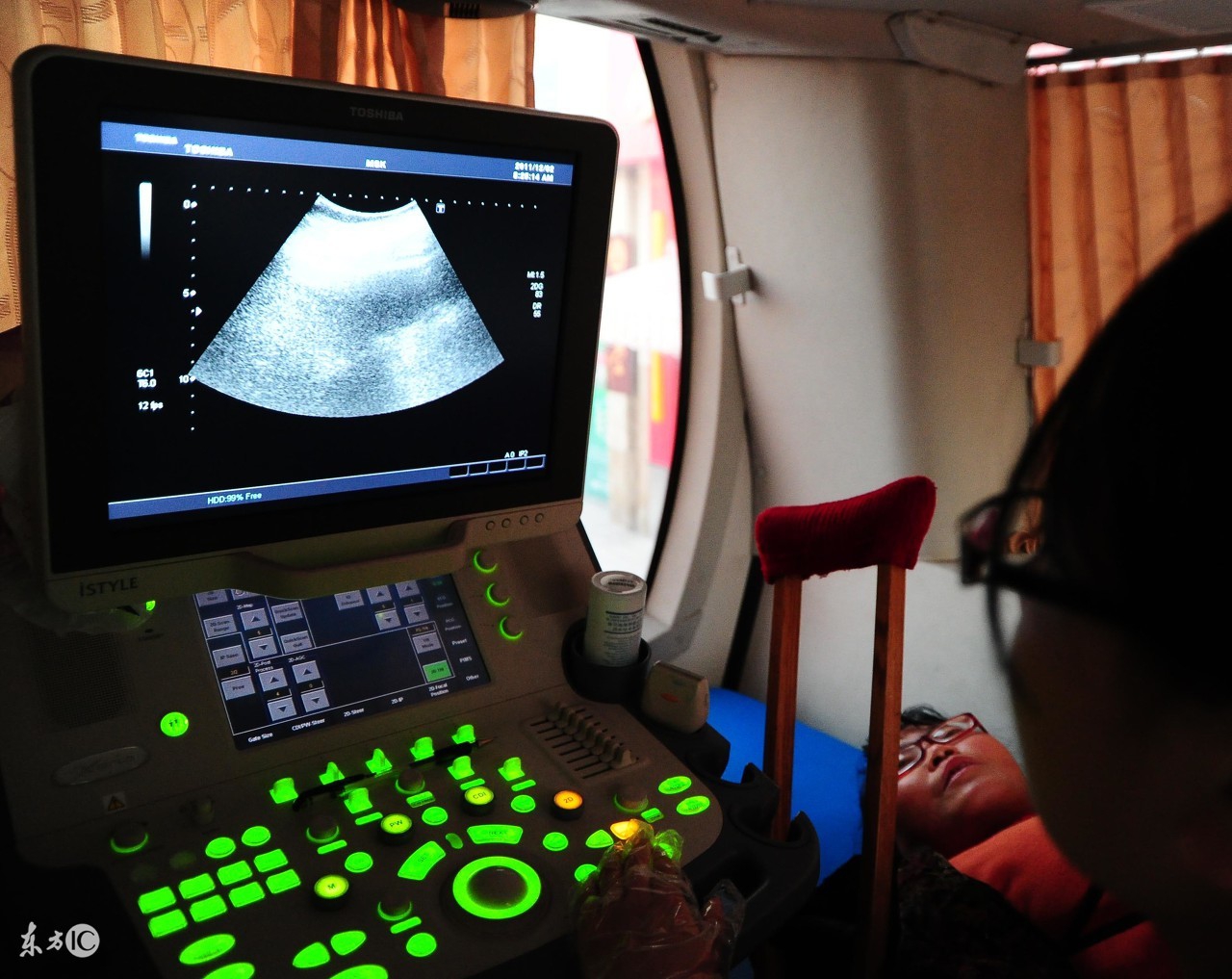 胎儿心脏什么问题才能是唐氏儿,唐氏筛查低风险胎儿心脏有强光斑