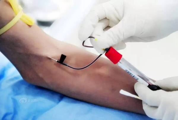 手指采完血针眼鼓包,采完血气胳膊为什么很酸