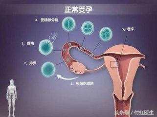 吃了左氧氟沙星结果怀孕了能要吗,左氧氟沙星吃了发现怀孕了能要吗