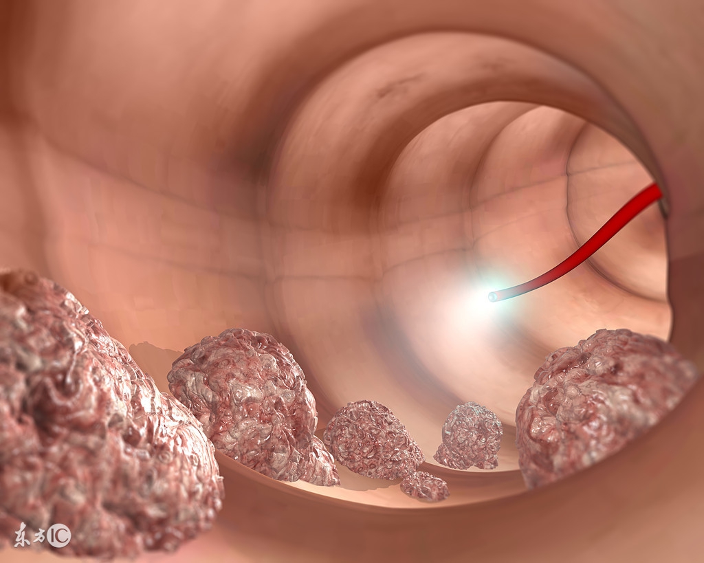 专家支招常见肠胃问题该怎么办,肠胃不舒服医生检查视频