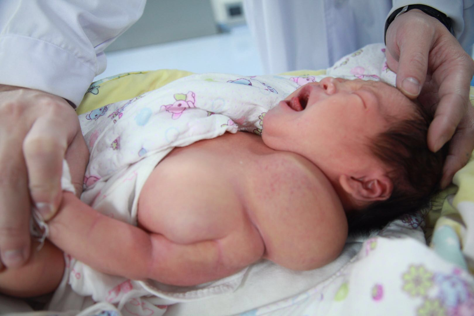 刚出生婴儿头顶有个凸起的包,新生儿右脖子有个小肿块