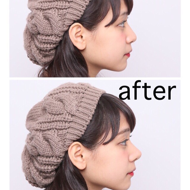 美鼻夹鼻梁增高器,缩小鼻翼鼻梁增高3d神器