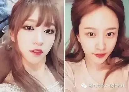 纹美瞳线七天脱痂过程图,纹美瞳线掉痂后反色过程图