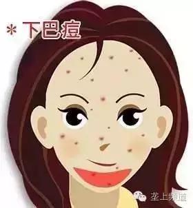 脸上长痘痘可以用醋洗脸吗,用醋洗面会长痘