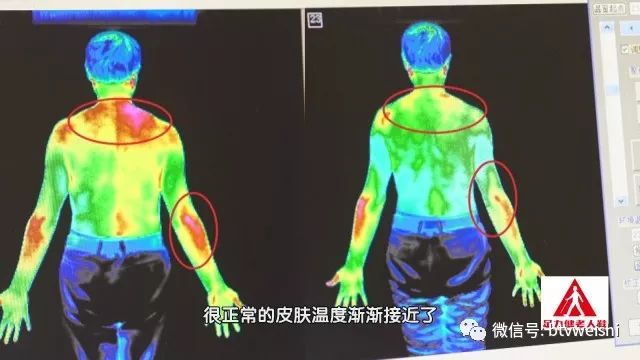 平衡针灸养生堂,养生堂针灸绝技