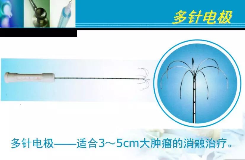 胆管肿瘤射频消融术,肿瘤射频消融厂家