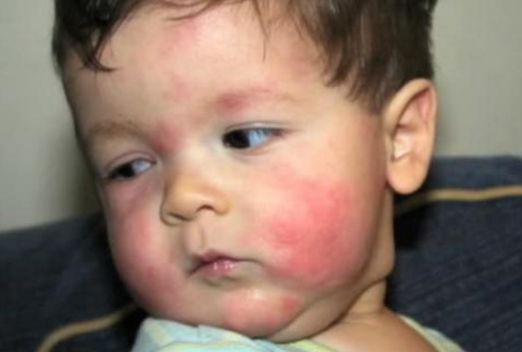 崔玉涛说婴儿不能吃的水果,崔玉涛一岁宝宝可以吃哪些