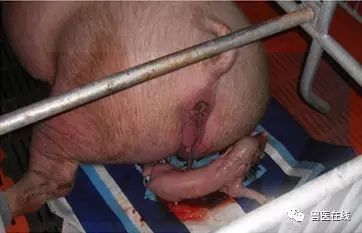 催产素副作用和危害,催产素对胎儿有伤害嘛