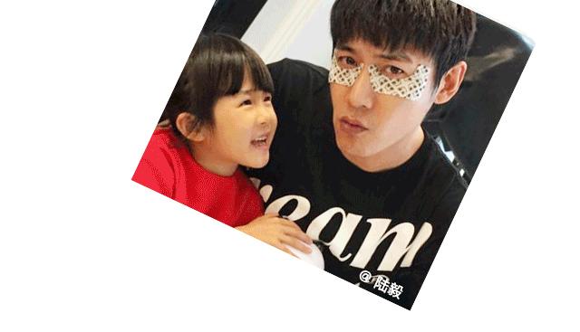 林允黄金眼膜推荐,林允资生堂眼膜