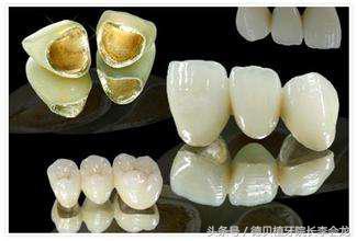 烤瓷牙表面掉瓷了对人身体有害吗,钴铬合金烤瓷牙对身体有害吗