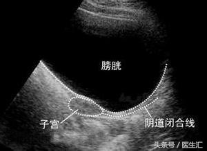 原发闭经的定义,原发闭经调理