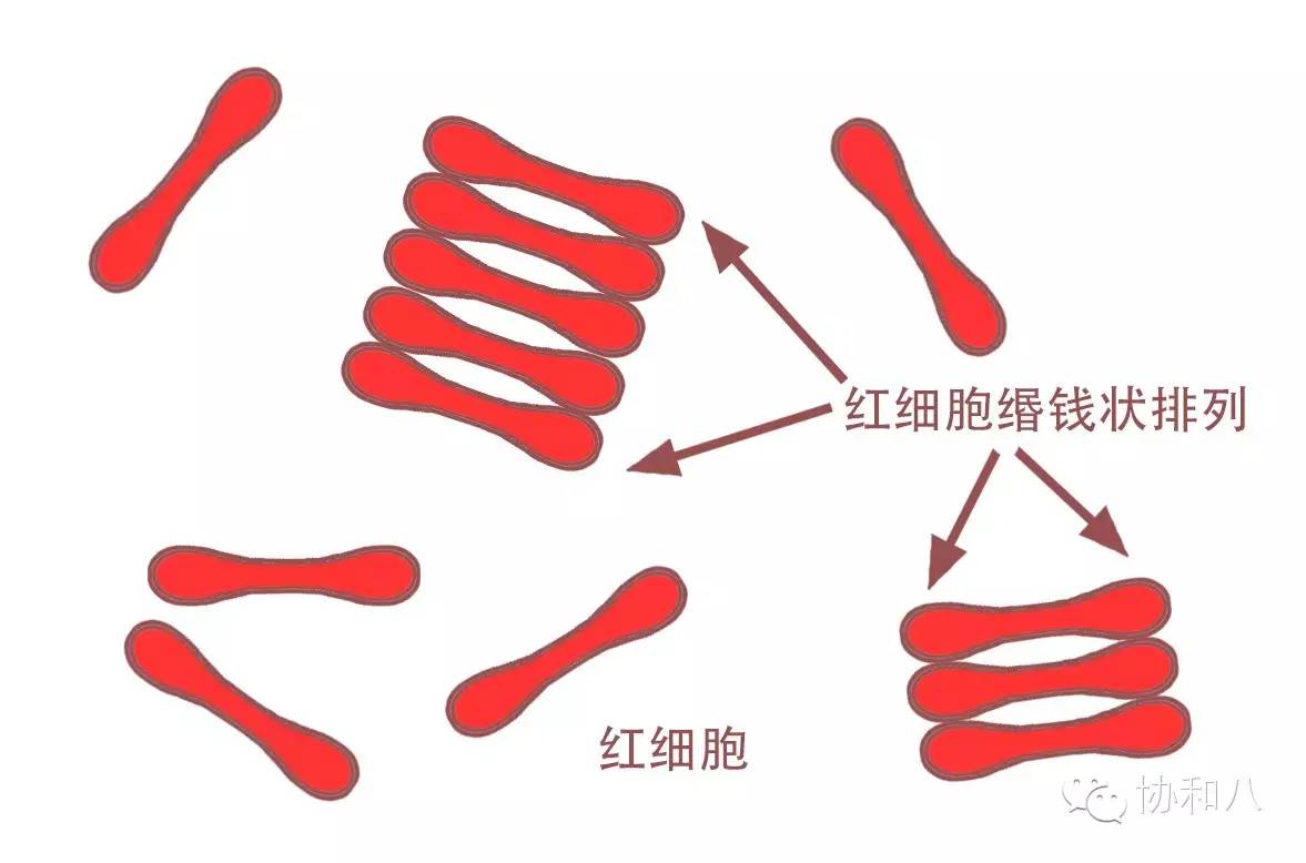 是COOMBS，不是Combs|一页手册·协和八