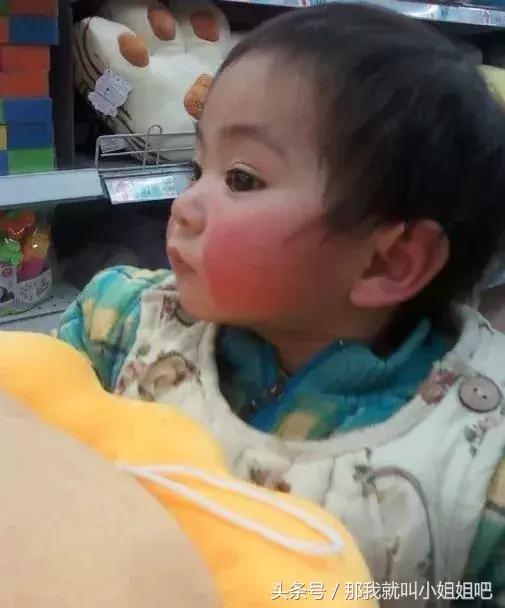 宝宝秋冬季红脸蛋的原因,宝宝秋冬红脸蛋怎么回事