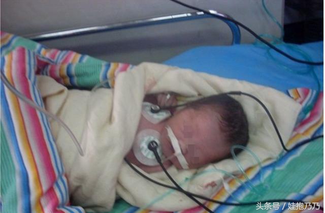 孕期喜欢吃口香糖,孕妇爱吃口香糖