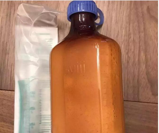 孩子高烧的原因是什么,孩子高烧一般是什么引起的