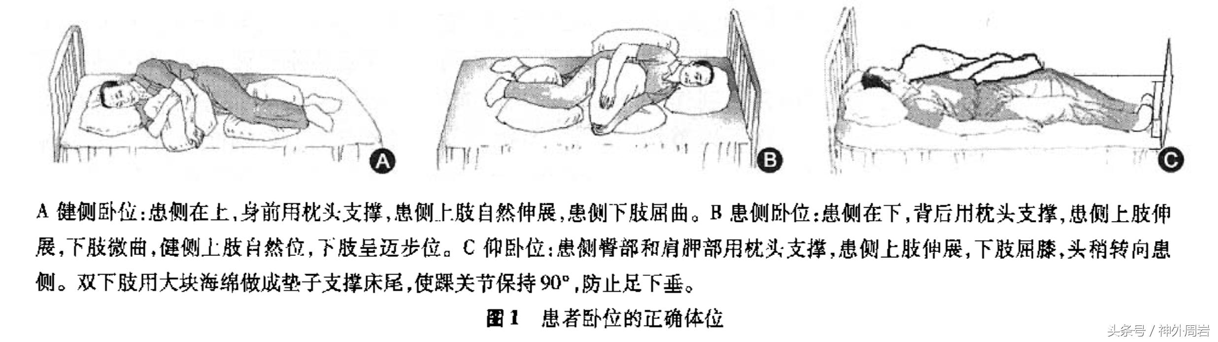 脑卒中康复治疗包括哪些,脑卒中康复训练需要做哪些