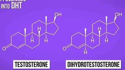 麦当劳薯条治疗脱发,麦当劳薯条掉头发