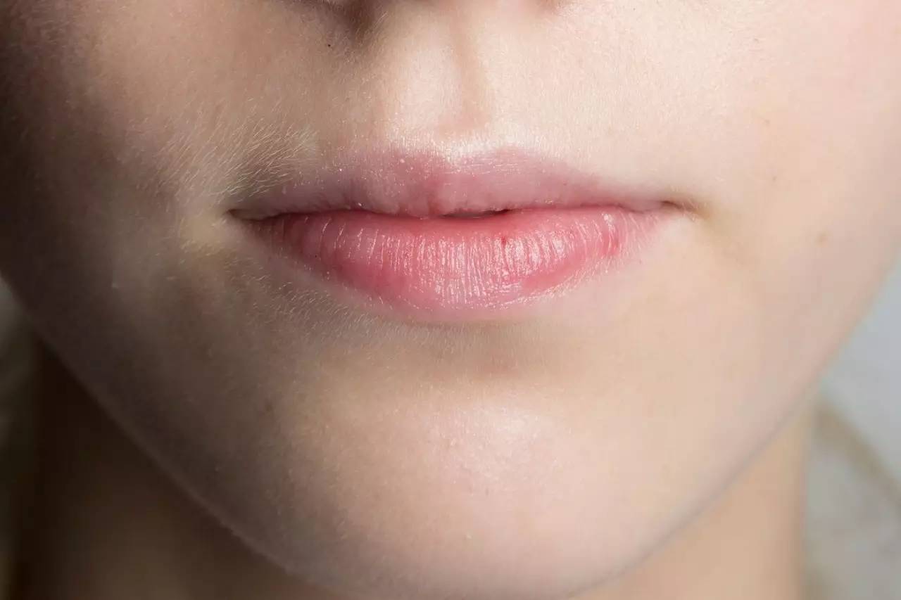 黑头为啥挤了第二天就出来了,黑头挤了两三次会变大嘛