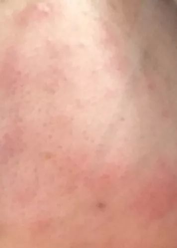 我又过敏了！拉黑！吐槽！说说那些年我跟风买过的糟心货！