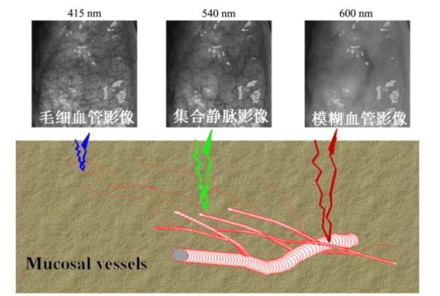 内镜检查痛苦吗,内镜检查是怎么做的