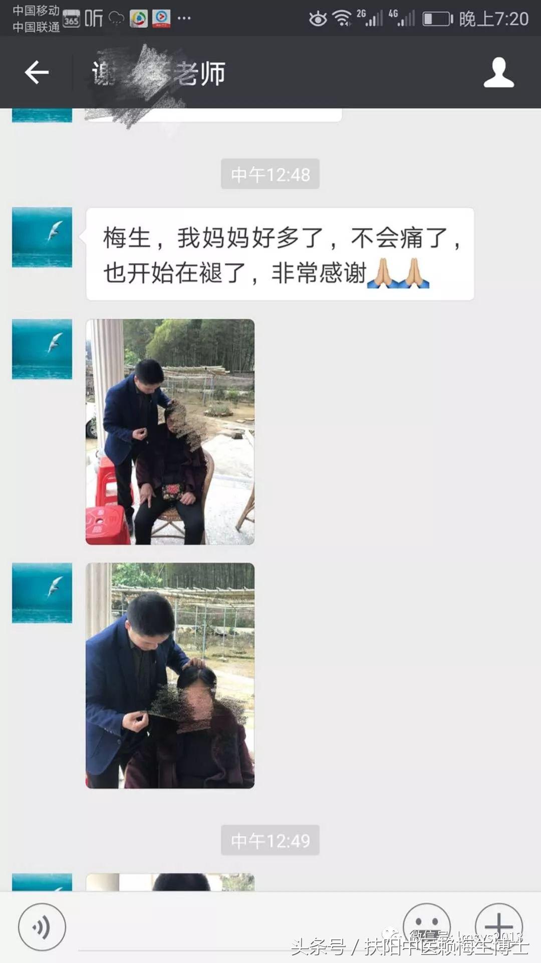 治疗带状疱疹用针灸和放血,带状疱疹内针治疗