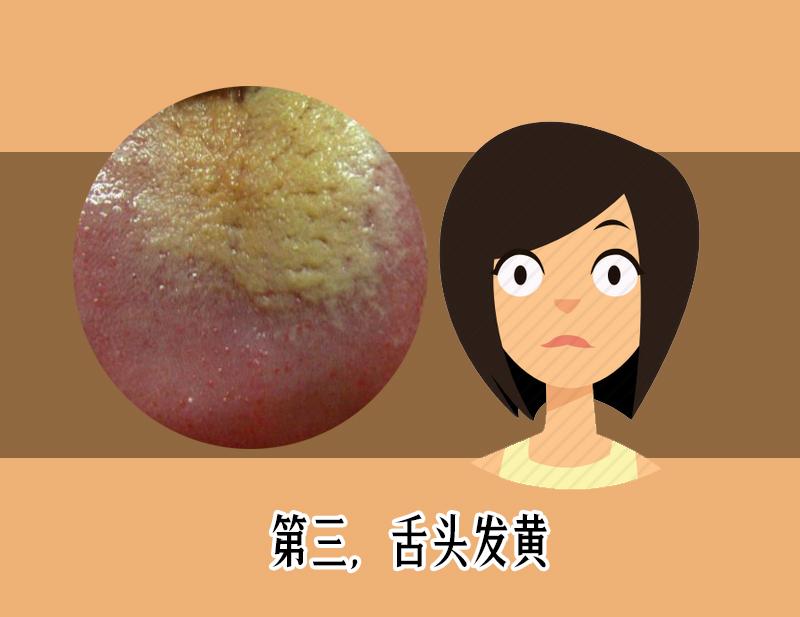 舌头鲜红有舌苔是怎么回事,舌头舌苔很厚变成黑色怎么回事