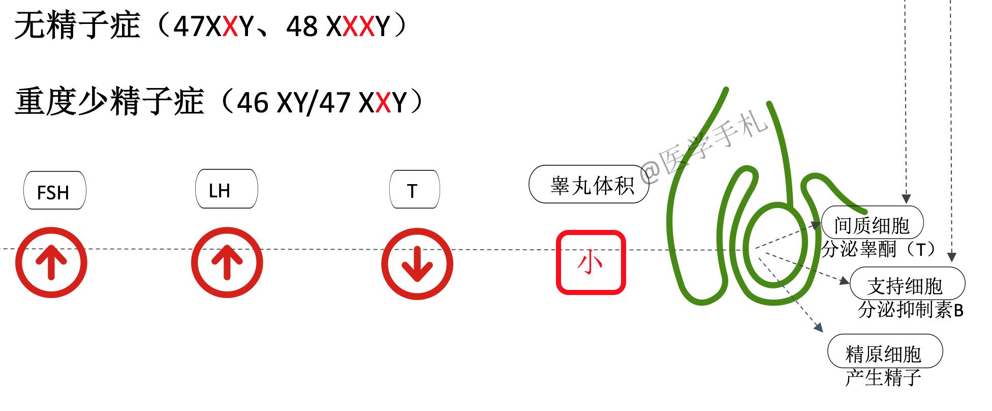 克氏综合征未来可以攻克吗,克氏综合征最新研究成果