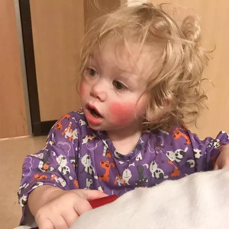 宝宝对净水器水过敏,对水过敏宝宝