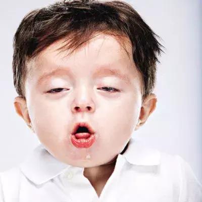 宝宝对净水器水过敏,对水过敏宝宝